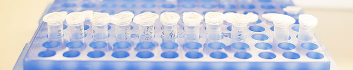 Photo of test tubes in a blue tray